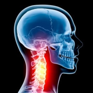 Neck Injuries in Maryland Workers Compensation Claims